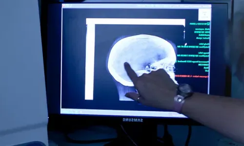 Radiology Tech in Florida Examining X-Ray